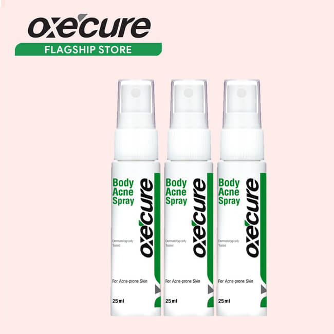 OXECURE Body Acne Spray 25ml Buy 25ml (Buy 2 Get 1 Free)