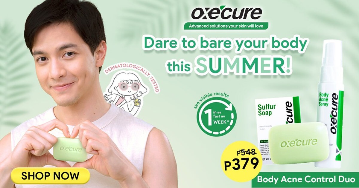 say goodbye to acne with Oxecure acne-clearing must-haves